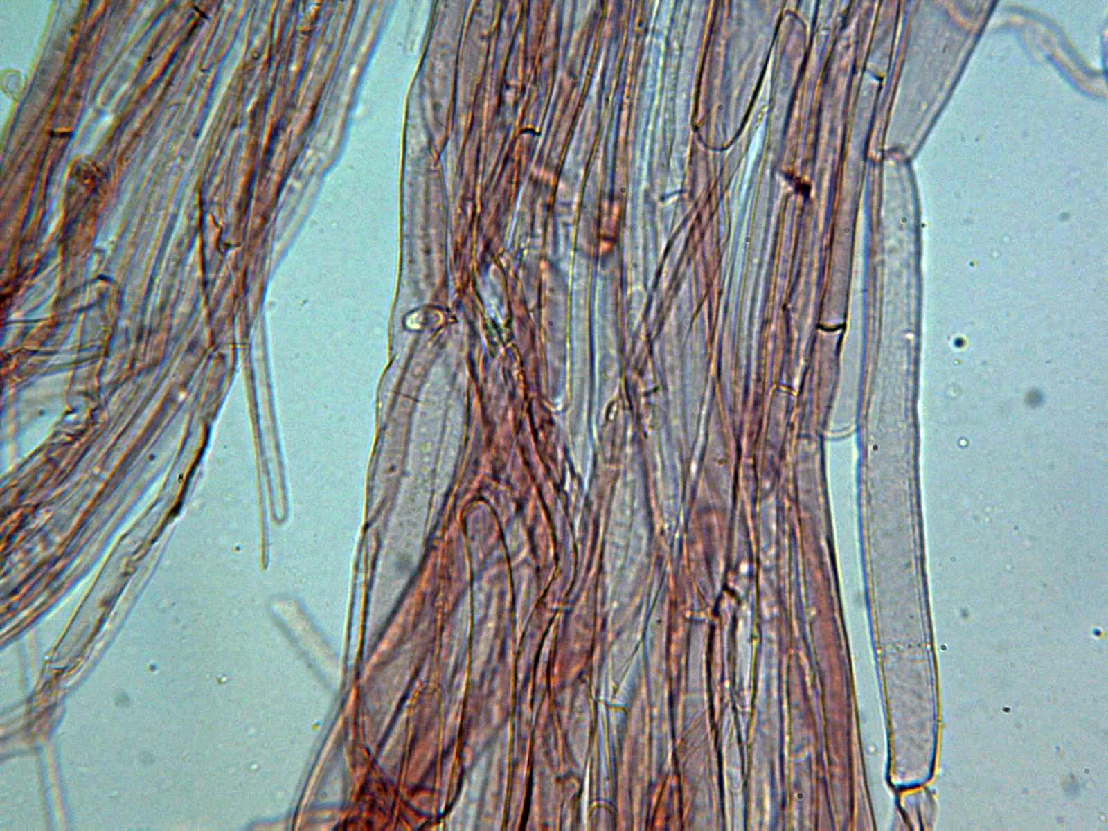 Microscopía de Limacella furnacea - 10 - Estípite x 400 sin caulos